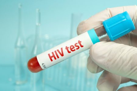 U Crnoj Gori registrovane 43 osobe sa HIV/AIDS-om u 2025. i početkom 2026, zabilježen jedan smrtni slučaj