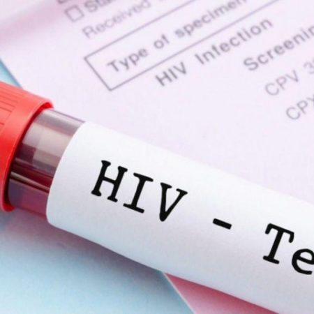 Izvještaj Instituta za javno zdravlje: Registrovan porast broja novootkrivenih slučajeva HIV infekcije u Crnoj Gori